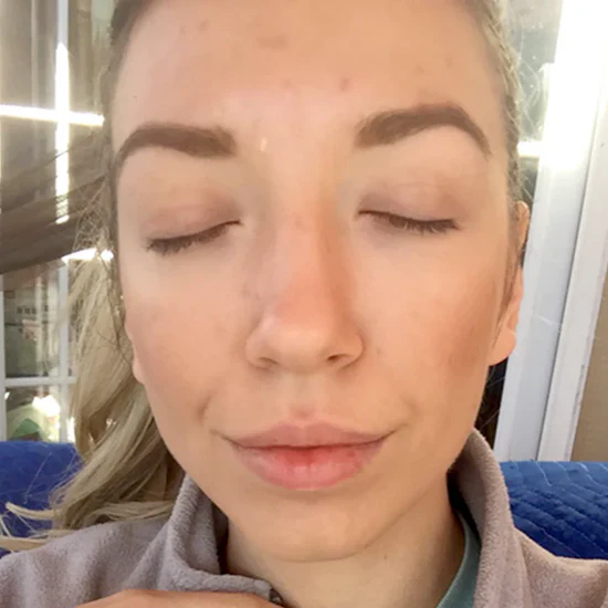 after-img_361ac4c5-be50-4c56-be66-6a46a7be4ca8