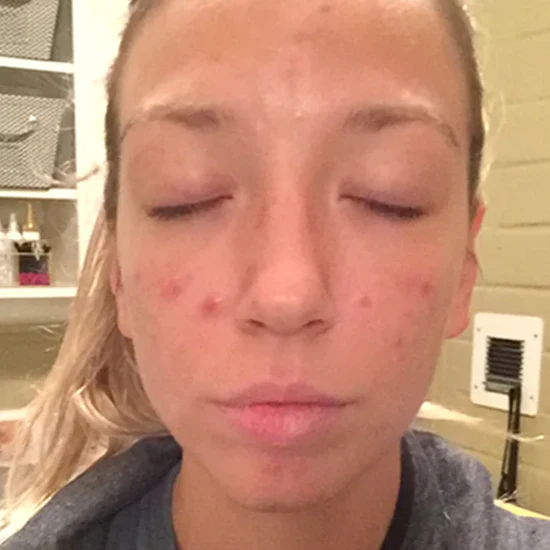 before-img_e26b1f59-8d27-4392-8dd4-60434d4a5b8a